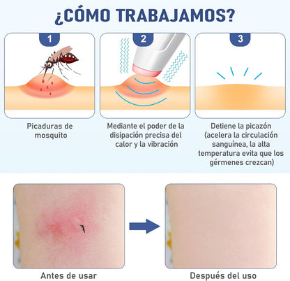 LumiGlow | Bolígrafo Antipicaduras con Calor y Vibración